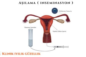 Aşılama ( İnseminasyon )